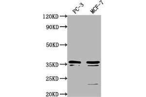 Western Blot Positive WB detected in: PC-3 whole cell lysate, MCF-7 whole cell lysate All lanes: OR6C1 antibody at 1:1000 Secondary Goat polyclonal to rabbit IgG at 1/50000 dilution Predicted band size: 36 kDa Observed band size: 36 kDa (OR6C1 抗体  (AA 259-275))
