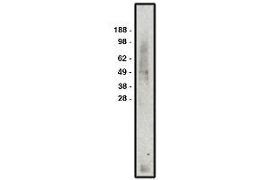 Western blot analysis using MCT3 antibody  used at 1:50k dilution. (MCT3 抗体)