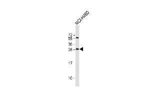 Anti-FGF18 Antibody (N-term) at 1:2000 dilution + NCI- whole cell lysate Lysates/proteins at 20 μg per lane. (FGF18 抗体  (N-Term))