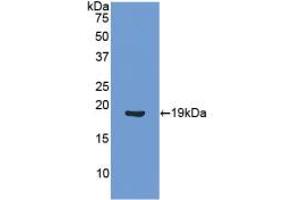Western blot analysis of recombinant Human ANGPT1. (Angiopoietin 1 抗体  (AA 284-452))