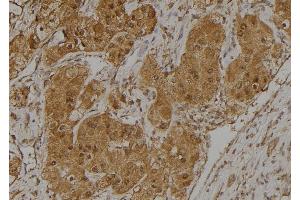 ABIN6275025 at 1/100 staining Human kidney tissue by IHC-P. (CCDC102B 抗体  (Internal Region))