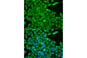 Immunofluorescence analysis of A549 cells using CSNK1G2 antibody. (Casein Kinase 1 gamma 2 抗体)