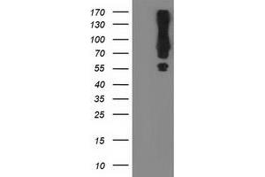 Western Blotting (WB) image for anti-Mahogunin, Ring Finger 1 (MGRN1) antibody (ABIN1499457) (Mahogunin RING Finger Protein 1 抗体)