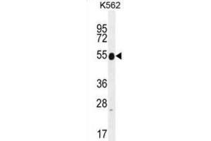Western Blotting (WB) image for anti-Keratin 25 (KRT25) antibody (ABIN2996108)