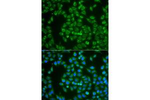 Immunofluorescence analysis of A549 cell using MAP4K3 antibody. (MAP4K3 抗体)