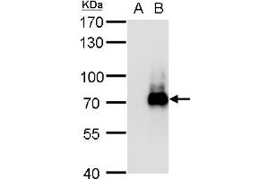 WB Image TRIM32 antibody detects TRIM32 protein by western blot analysis. (TRIM32 抗体)