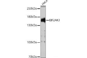 Western blot analysis of extracts of HeLa cells using EIF2AK3 Polyclonal Antibody at dilution of 1:1000. (PERK 抗体)