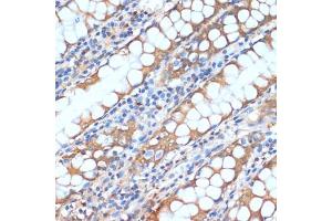 Immunohistochemistry of paraffin-embedded human colon using HHL antibody (ABIN6132190, ABIN6141750, ABIN6141751 and ABIN6217197) at dilution of 1:100 (40x lens). (HHLA2 抗体  (AA 30-200))