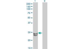 Western Blotting (WB) image for anti-RAB27A, Member RAS Oncogene Family (RAB27A) (AA 122-222) antibody (ABIN598569) (RAB27A 抗体  (AA 122-222))