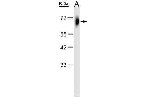 WB Image Sample(30 μg of whole cell lysate) A:HeLa S3, 10% SDS PAGE antibody diluted at 1:1000 (TRIM23 抗体  (N-Term))