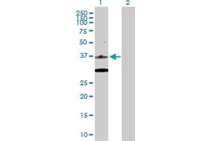 Western Blot analysis of CDK6 expression in transfected 293T cell line by CDK6 MaxPab polyclonal antibody. (CDK6 抗体  (AA 1-326))