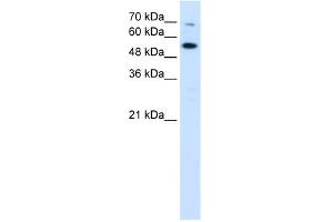 WB Suggested Anti-CHEK2 Antibody Titration:  0. (CHEK2 抗体  (N-Term))