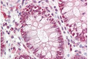 Immunohistochemistry (IHC) image for anti-Caudal Type Homeobox 2 (CDX2) (AA 1-60) antibody (ABIN1100745)