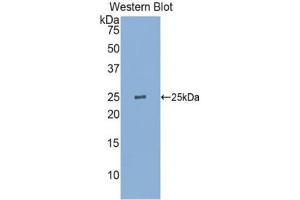 Detection of Recombinant GSTp, Human using Polyclonal Antibody to Glutathione S Transferase Pi (GSTp) (GSTP1 抗体  (AA 1-210))