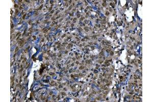IHC analysis of Ki67/MKI67 using anti-Ki67/MKI67 antibody (ABIN7601873). (Ki-67 抗体  (AA 5-2358))