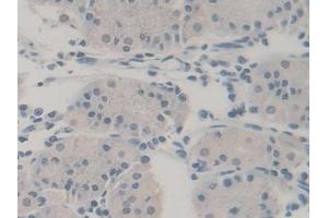 Detection of UBA52 in Human Stomach Tissue using Polyclonal Antibody to Ubiquitin A 52 Residue Ribosomal Protein Fusion Product 1 (UBA52)