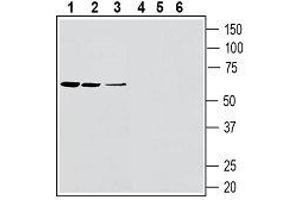 Western Blotting (WB) image for anti-Solute Carrier Family 11 (Proton-Coupled Divalent Metal Ion Transporters), Member 1 (SLC11A1) (AA 322-335), (Extracellular) antibody (ABIN7043670)