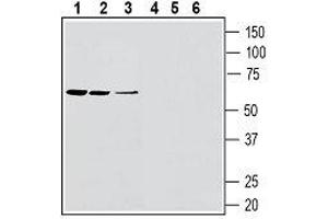 Western blot analysis of rat spleen lysates (lanes 1 and 4), rat lung membranes (lanes 2 and 4) and mouse lung membranes (lanes 3 and 6): - 1-3. (SLC11A1 抗体  (4th Extracellular Loop))