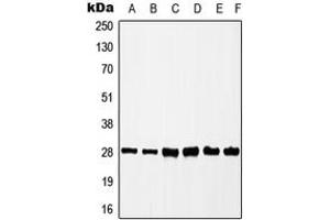Western blot analysis of CK2 beta (pS209) expression in HEK293T (A), MCF7 (B), HepG2 (C), K562 (D), mouse liver (E), rat spleen (F) whole cell lysates. (CSNK2B 抗体  (C-Term, pSer209))