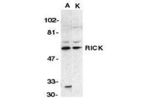 Western Blotting (WB) image for anti-ROP Interactive Partner 2 (RIP2) (N-Term) antibody (ABIN2476367)