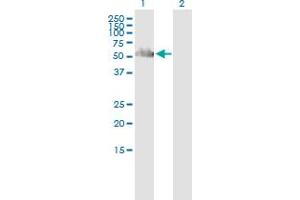 Western Blot analysis of PNKP expression in transfected 293T cell line by PNKP polyclonal antibody (A01). (PNKP 抗体  (AA 422-521))