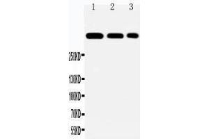 Anti-Laminin 2 alpha antibody, Western blotting Lane 1: HELA Cell Lysate Lane 2: A549 Cell Lysate Lane 3: PANC Cell Lysate