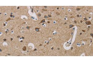 Immunohistochemistry of paraffin-embedded Human brain using COX6B1 Polyclonal Antibody at dilution of 1:50 (COX6B1 抗体)