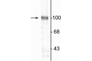 Western blot of a rat hippocampal lysate showing the specific immunolabeling of the ~100 kDa GluR2 protein. (GRIA2 抗体)