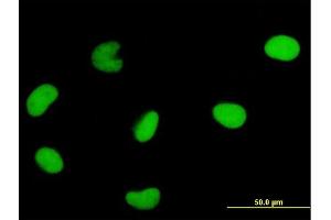 Immunofluorescence of monoclonal antibody to DUT on HeLa cell. (Deoxyuridine Triphosphatase (DUT) (AA 68-164) 抗体)