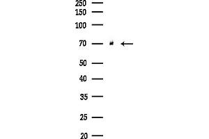 Western blot analysis of lysates from Hela cells(starvation,24h treatment), using ARFGAP3 Antibody at 1/1000 dilution.