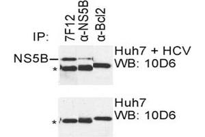 IP was carried out with NS5B specific mAb 7F12 using the lysates of Huh7 cells harboring selectable subgenomic HCV RNA replicon (upper panel) or plain Huh7 cells (lower panel). (HCV 1b NS5B 抗体  (AA 77-86))