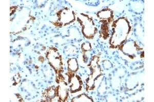 FFPE human renal cell carcinoma tested with Lactadherin antibody (EDM45) (MFGE8 抗体)