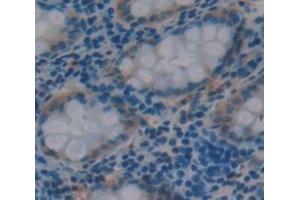 Figure. (CLCA1 抗体  (AA 416-670))