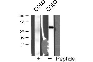 Western blot analysis of Interleukin 2 receptor β expression in COLO cells (IL2 Receptor beta 抗体  (N-Term))