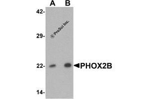 Western Blotting (WB) image for anti-Paired-Like Homeobox 2b (PHOX2B) (Middle Region) antibody (ABIN1031037) (PHOX2B 抗体  (Middle Region))