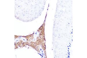 Immunohistochemistry of paraffin-embedded mouse testis using AMH Rabbit pAb (ABIN7265629) at dilution of 1:25 (40x lens). (AMH 抗体  (AA 20-280))