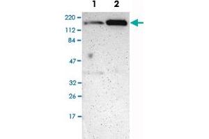 Western Blot analysis of Lane 1: RT-4 and Lane 2: U-251MG sp cell lysates with MYBBP1A polyclonal antibody . (MYBBP1A 抗体)