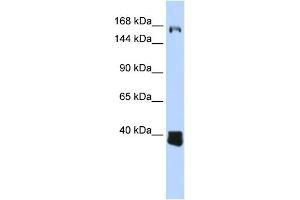 WB Suggested Anti-C10orf12 Antibody Titration: 0. (Lcor 抗体  (Middle Region))