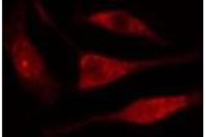 ABIN6277615 staining  Hela cells by IF/ICC. (UBD 抗体  (Internal Region))