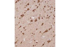 Immunohistochemical analysis of C on paraffin-embedded Human brain tissue.
