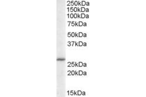 Image no. 1 for anti-Acidic (Leucine-Rich) Nuclear phosphoprotein 32 Family, Member B (ANP32B) (C-Term) antibody (ABIN374313)