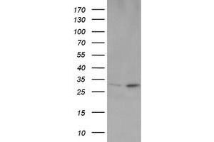 Image no. 2 for anti-OTU Domain, Ubiquitin Aldehyde Binding 1 (OTUB1) antibody (ABIN1499932) (OTUB1 抗体)