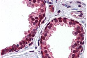 Immunohistochemistry (Formalin-fixed Paraffin-embedded Sections) (IHC (fp)) image for anti-serpin Peptidase Inhibitor, Clade A (Alpha-1 Antiproteinase, Antitrypsin), Member 3 (SERPINA3) (AA 254-303) antibody (ABIN768964)