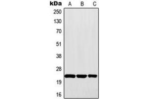 Western blot analysis of MAD2 expression in Raji (A), HepG2 (B), A431 (C) whole cell lysates. (MAD2 抗体  (Center))