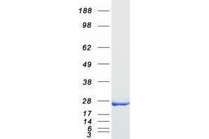 Validation with Western Blot (Transgelin Protein (TAGLN) (Transcript Variant 2) (Myc-DYKDDDDK Tag))