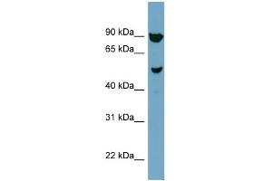 WB Suggested Anti-IRX2 Antibody Titration:  0. (IRX2 抗体  (N-Term))