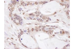 anti-Zinc Finger Protein 828 (ZNF828) (AA 762-812) antibody