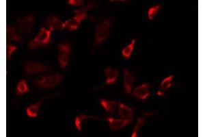 ABIN6275232 staining Hela by IF/ICC. (MRPS2 抗体  (C-Term))