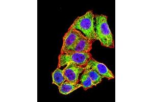 Immunofluorescence analysis of Hela cells using ALB mouse mAb (green). (Albumin 抗体  (AA 410-609))