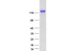 Validation with Western Blot